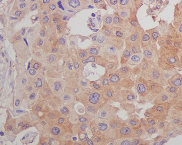 beta-Tubulin Mouse mAb