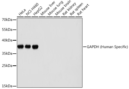 GAPDH Rabbit mAb