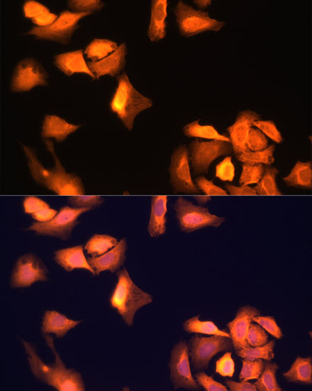 GAPDH rabbit monoclonal antibody
