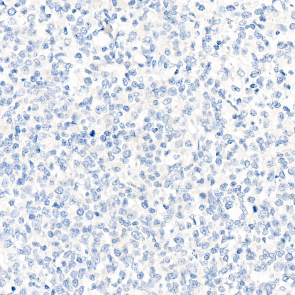 Rabbit IgG isotype control