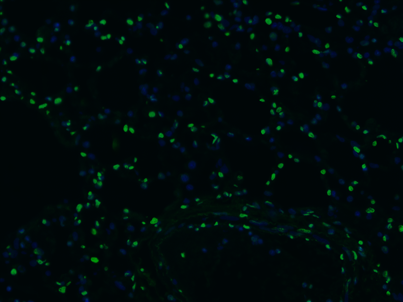 TUNEL Apoptosis Imaging Kit