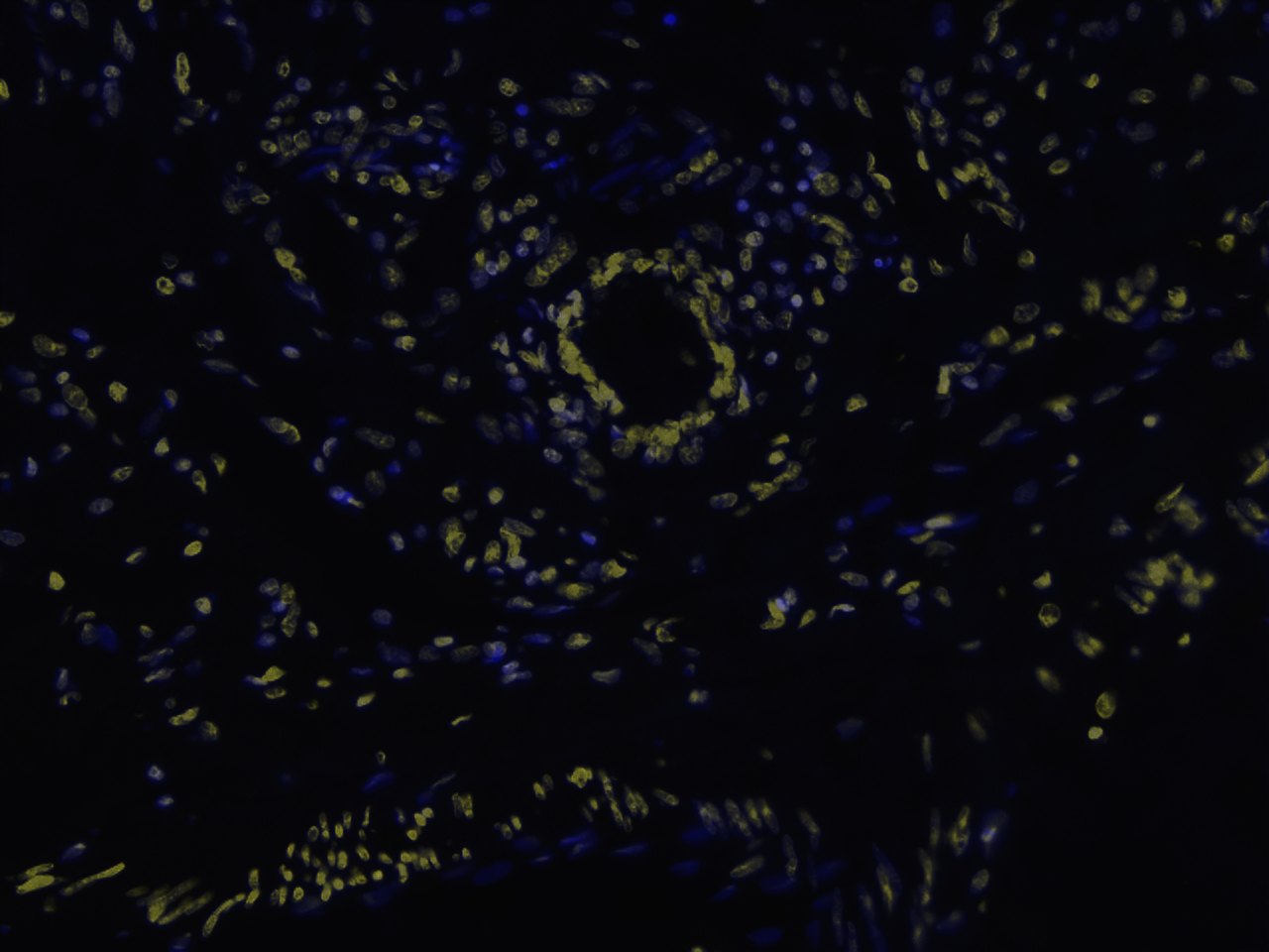 TUNEL Apoptosis Imaging Kit