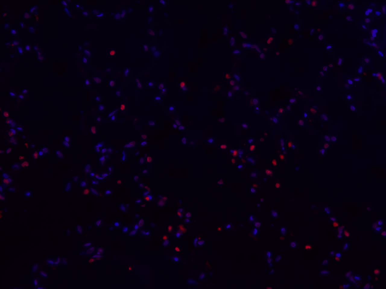 TUNEL Apoptosis Imaging Kit