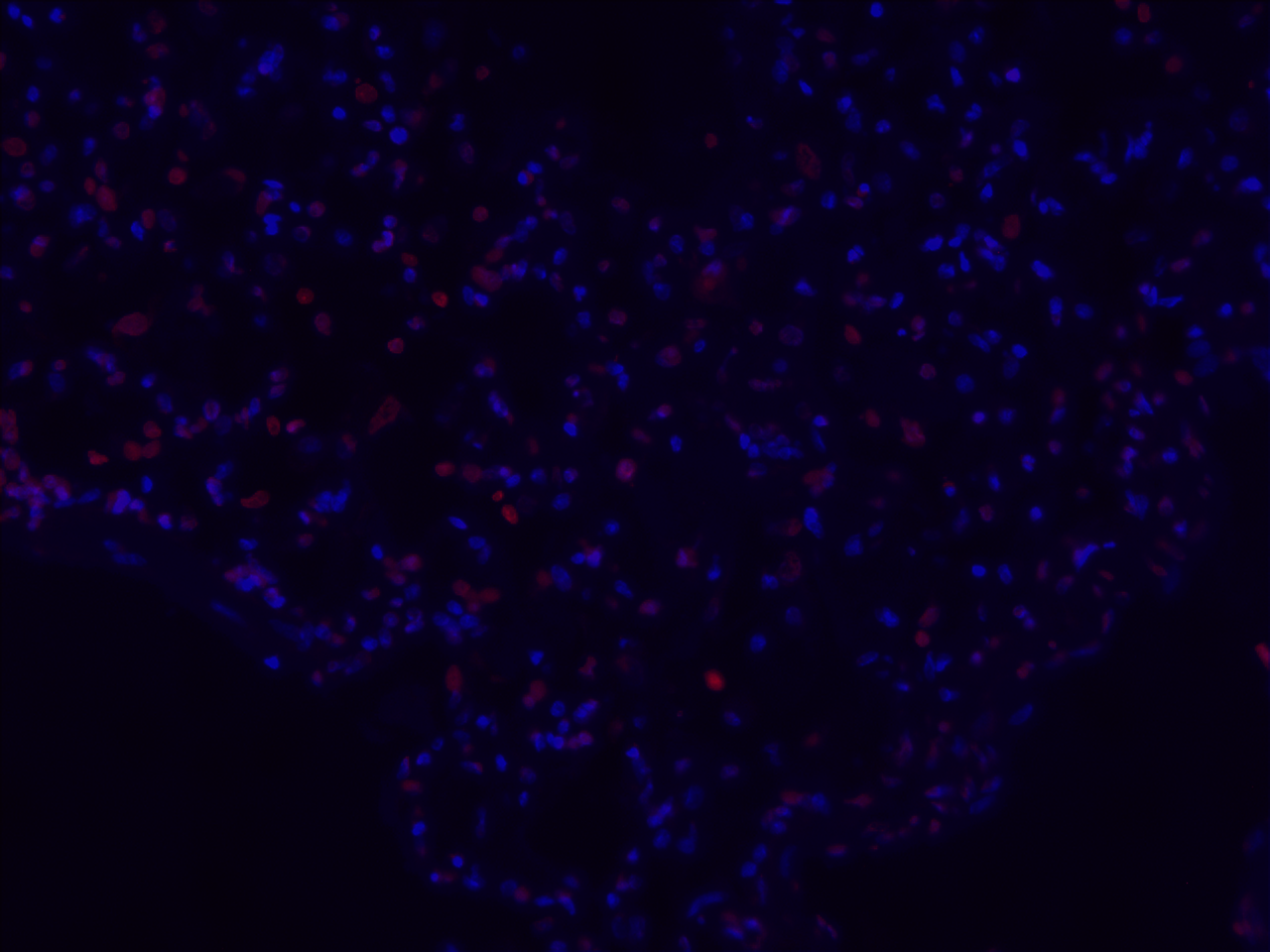TUNEL Apoptosis Imaging Kit