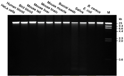 universal dna extraction kit