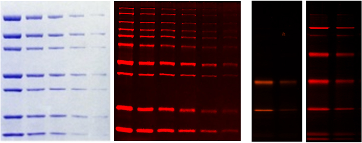 protein gel stain