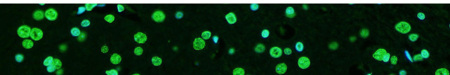 TUNEL Apoptosis Assay Kits