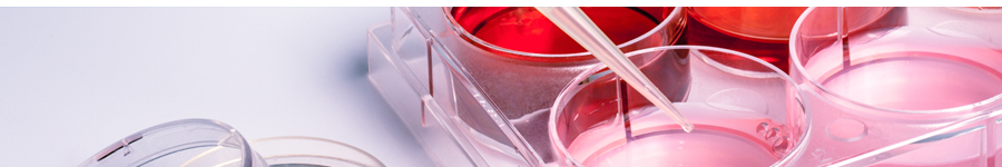 Custom Gene Editing Cell Lines