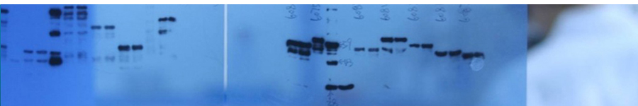 ECL WB Detection Kits